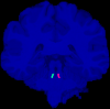 Graphic for Locus Coeruleus Manual Labels for 20 HCP Subjects