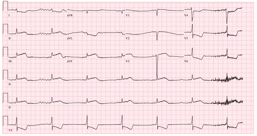 Example of time series: health monitoring records.