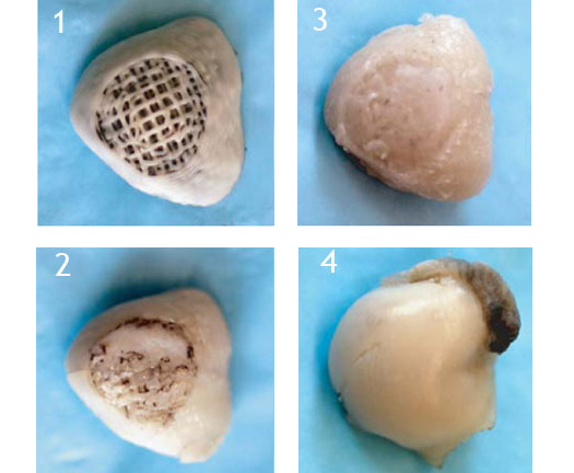 Bio-Scaffold Regenerates Rabbit Joints In Vivo While the Rabbits Run