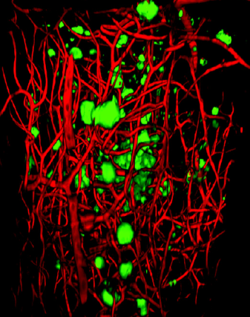 A Quick Soak In Solution Turns Brain Tissue Transparent