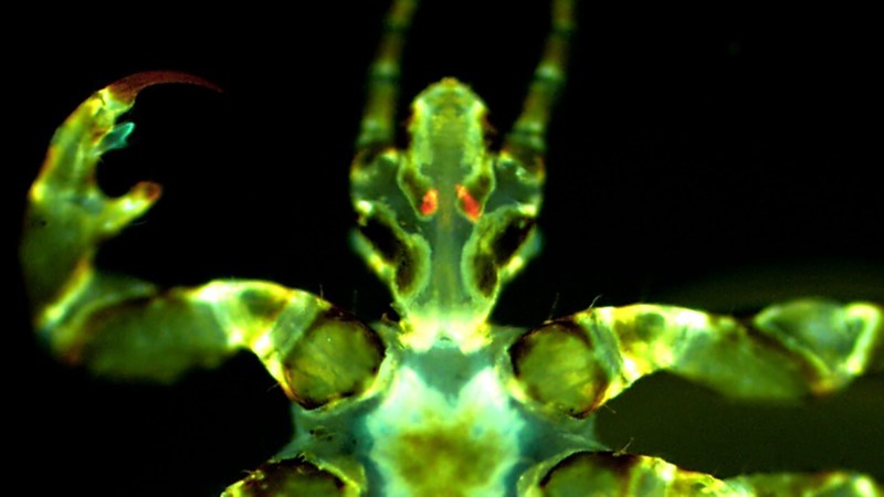 Fluorescent image of a human body louse with Yersinia pestis infection (seen in orange/red) in the Pawlowsky glands.