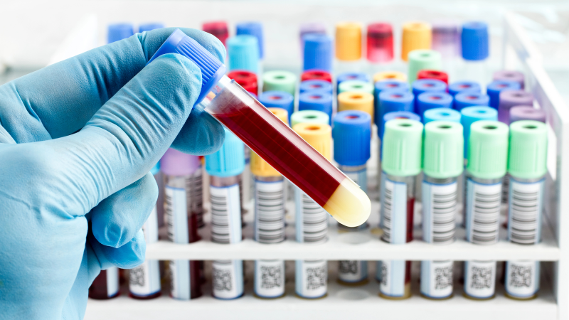 a scientists with a gloved hand prepares a blood sample in a test tube