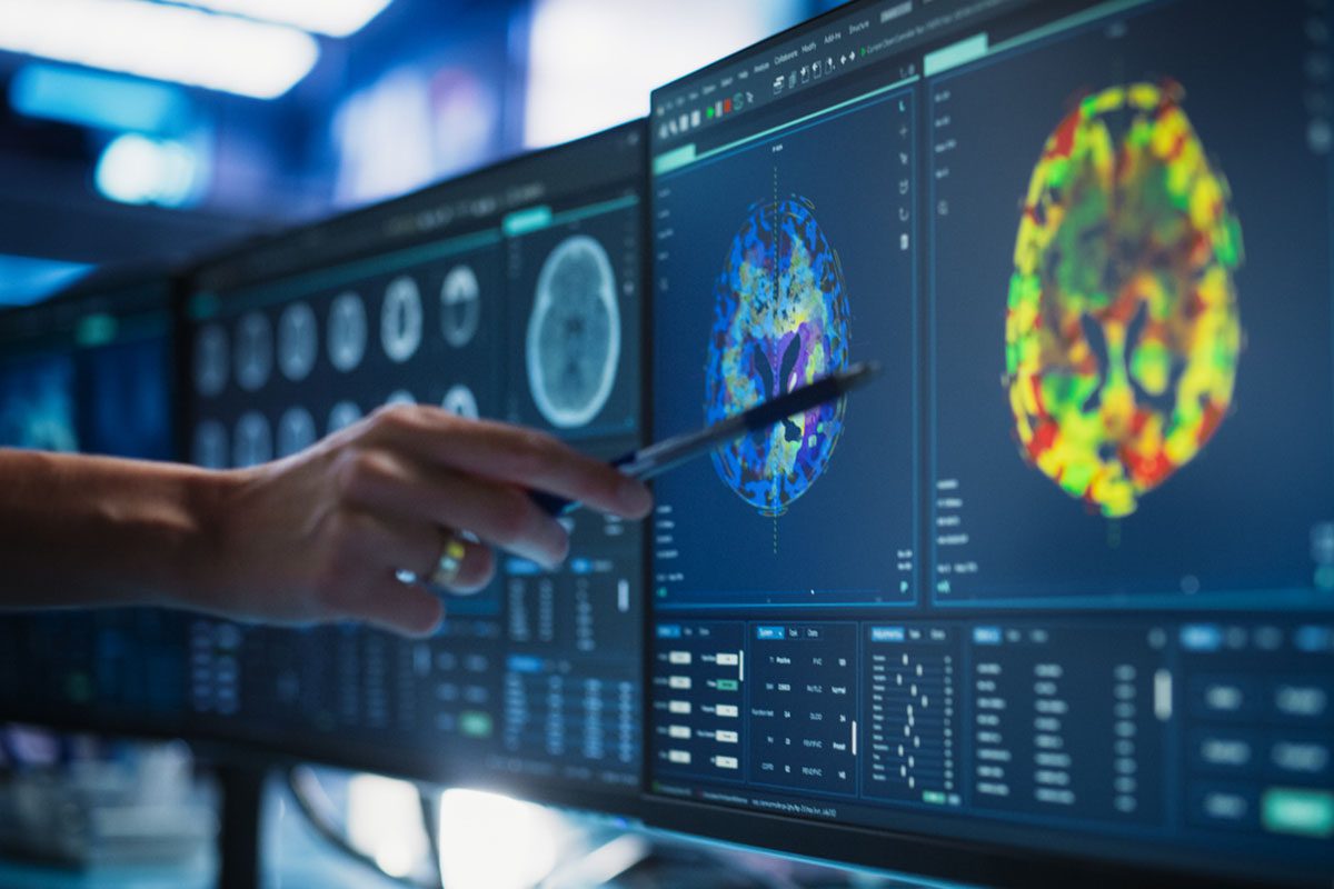 Cisplatin-Etoposide–Induced Hyperammonemic Encephalopathy