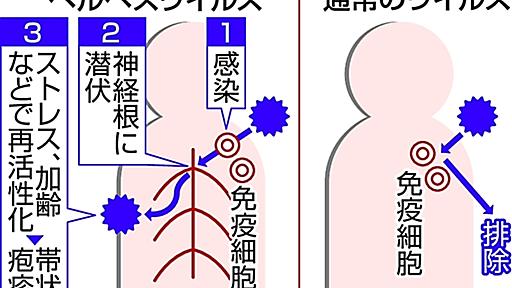 新型コロナウイルス、体内から追い出せず後遺症？　感染後に潜伏するヘルペスと類似　大阪大教授が指摘（2023年6月20日掲載）｜信濃毎日新聞デジタル　信州・長野県のニュースサイト