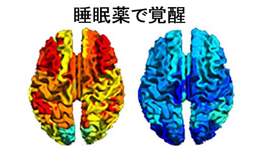 重度の脳障害患者が「睡眠薬」によって、逆に"意識を取り戻す"事例が報告される - ナゾロジー